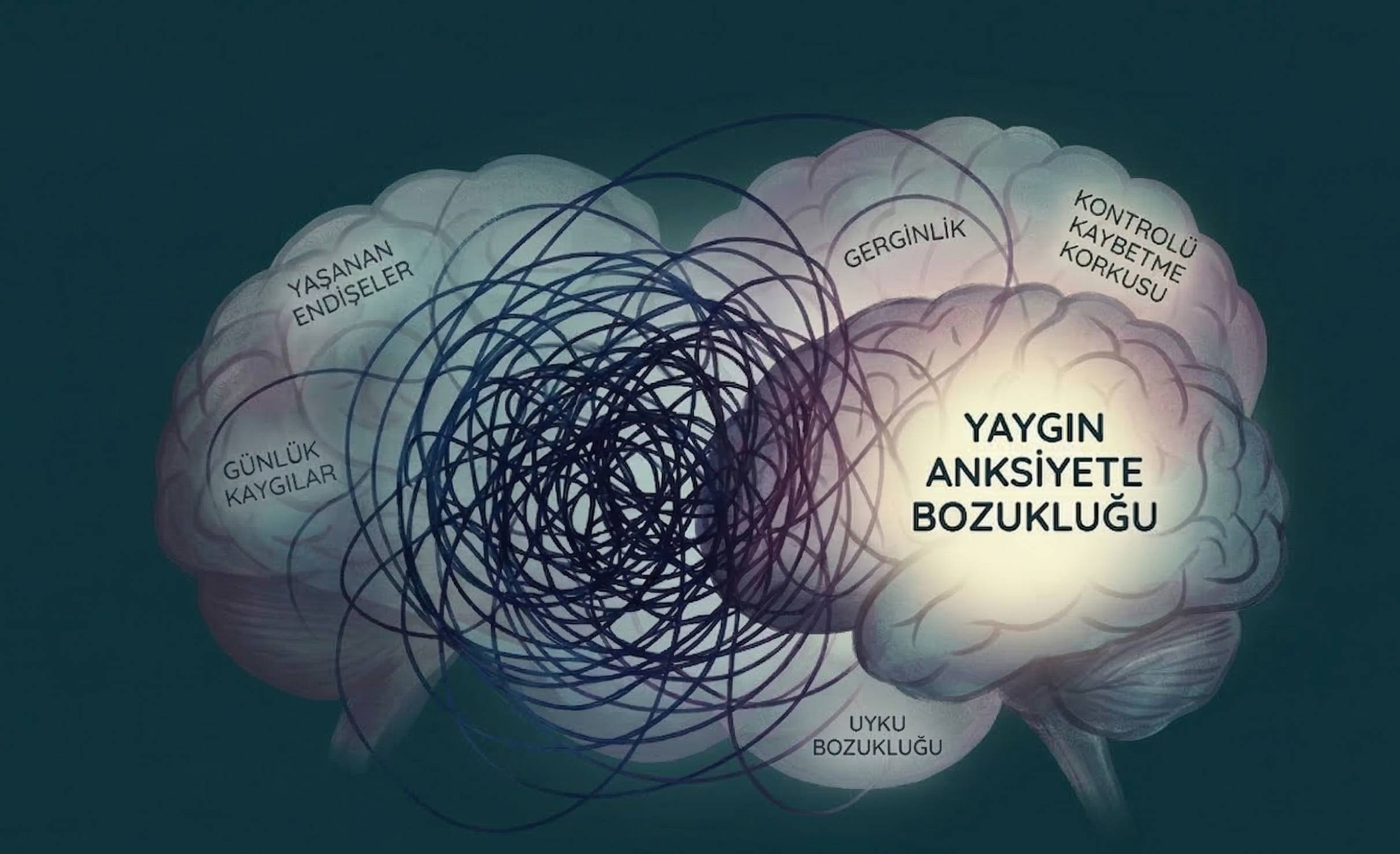 Yaygın Anksiyete Bozukluğu